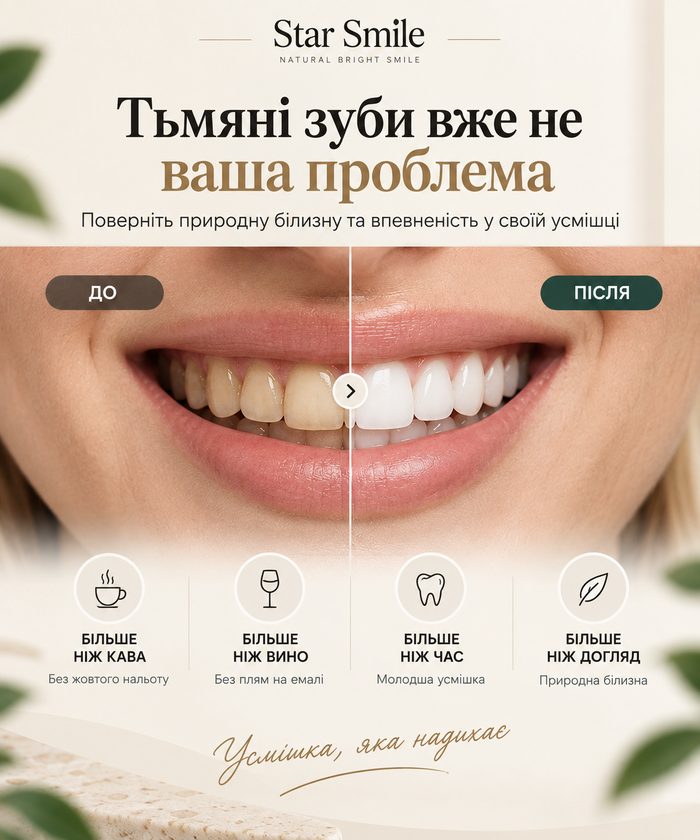 Тьмяні зуби вже не ваша проблема — до і після Star Smile